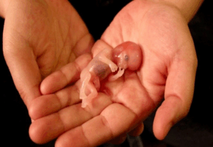 L'avortement jusqu'à la naissance : le révélateur de la morbidité de notre société ?